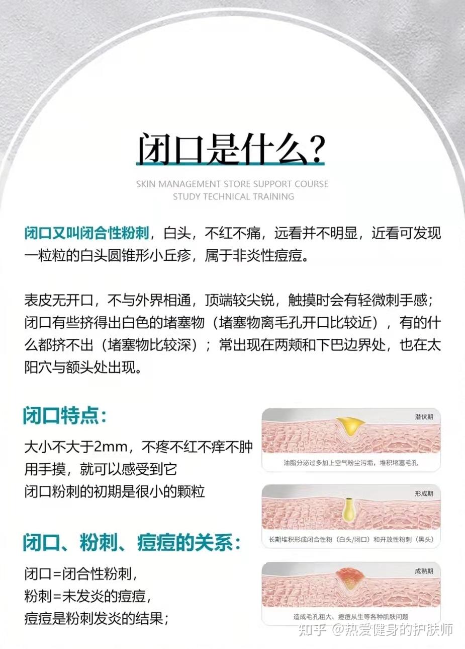 3分钟教你正确解决闭口 - 知乎