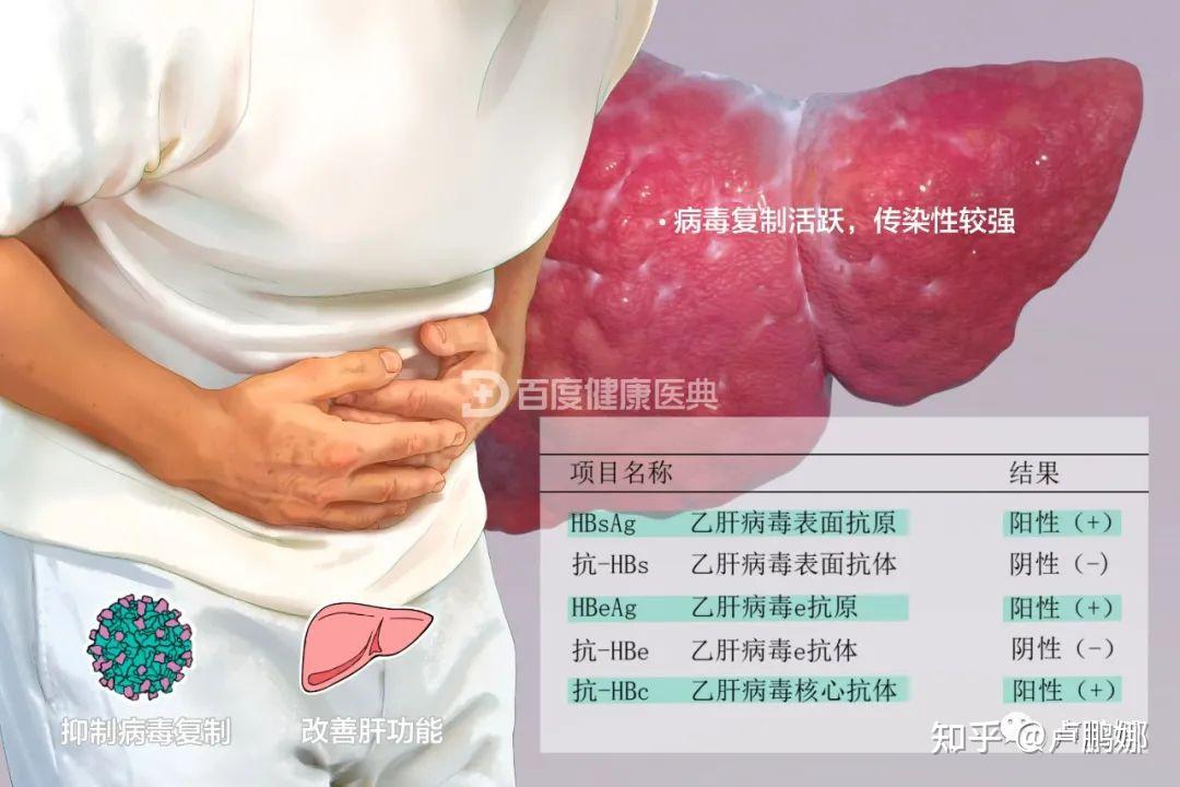 1乙肝大三阳,是怎么回事?
