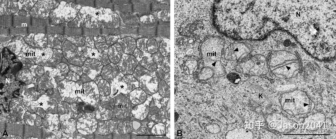 线粒体的透射电镜形态 - 知乎