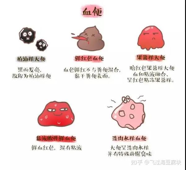 蛋花便、血便、豆腐渣便…宝宝出现这4种便便，需要马上送医院！ - 知乎