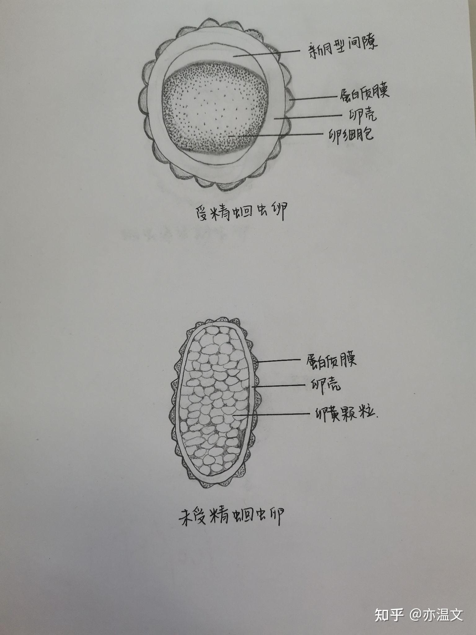 肝吸虫虫卵寄生虫画图图片