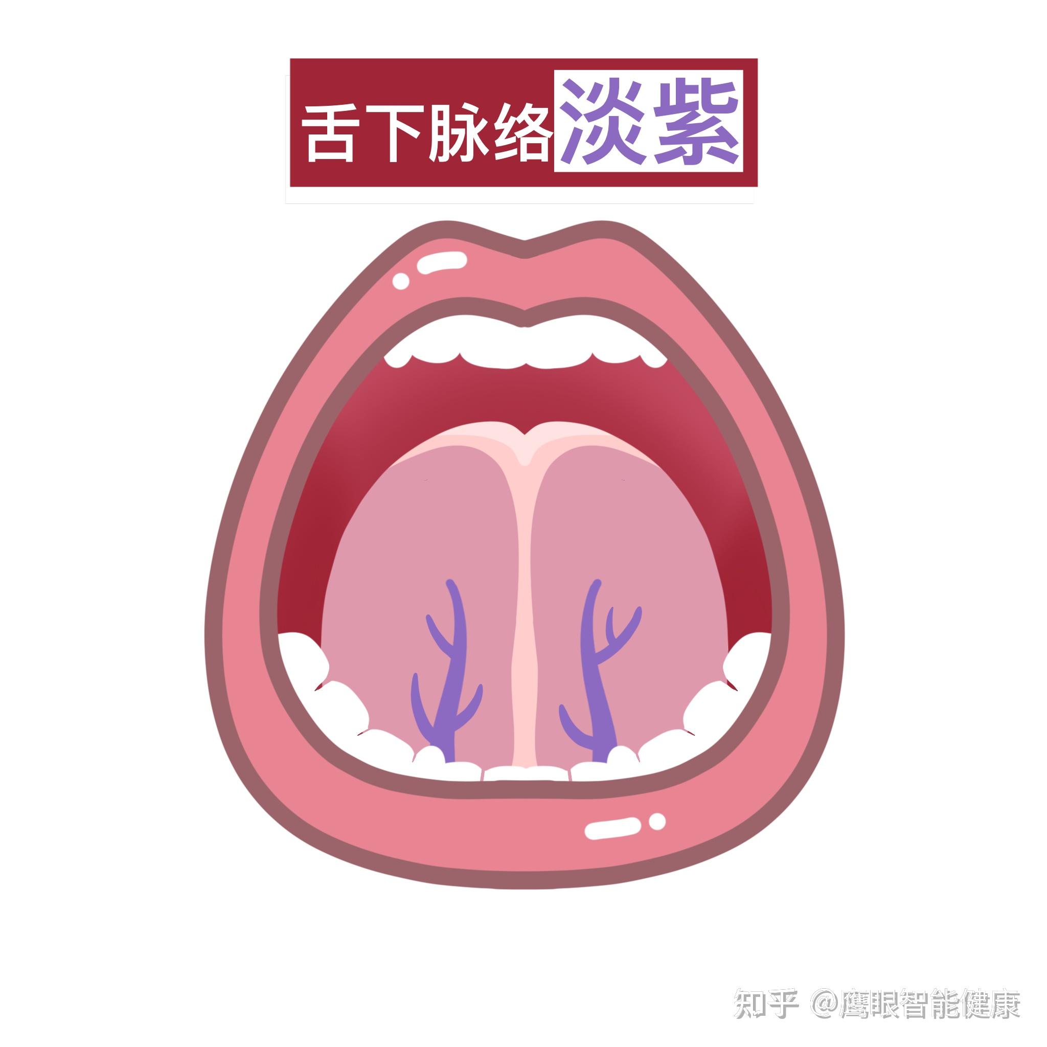 中医看舌底是看的什么?教你一招,轻松判断身体状况 - 知乎