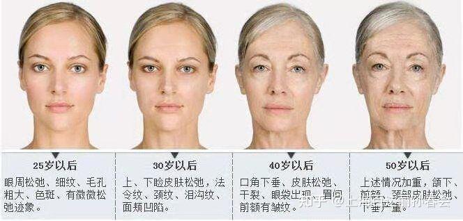 女性面部衰老分为几个阶段? 