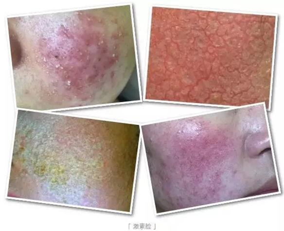 v2-2f715fe6f9ed81207c3cd5d885bb48b4_1440w.jpg?source=172ae18b