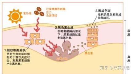 什么时候适合做医美项目 v2-2f9b3f1e4e136eae60945d397e1afc2d_r.jpg
