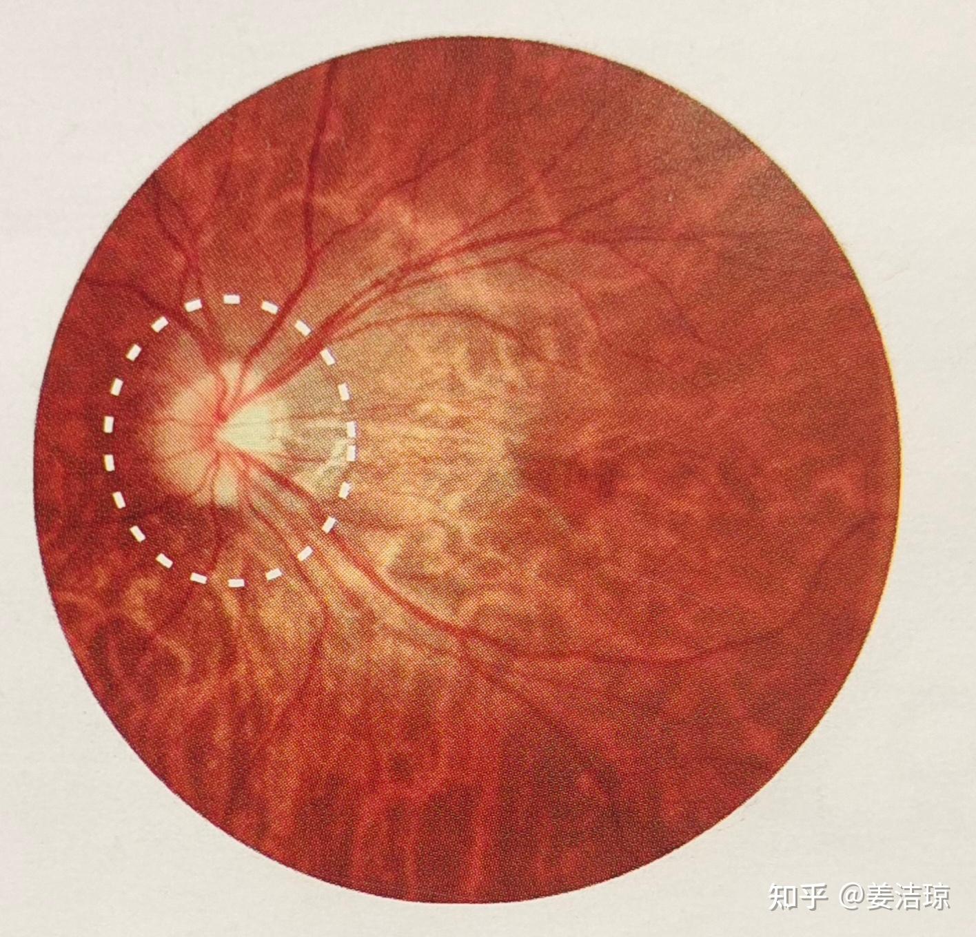 视网膜真实图片图片