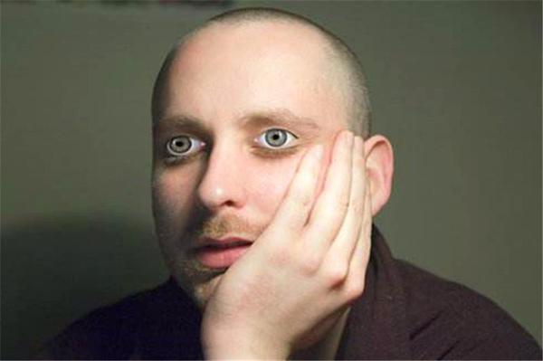 “睁眼睡”属于正常现象吗？ 知乎