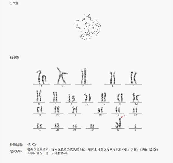 一文教你看懂染色体核型分析报告 - 知乎