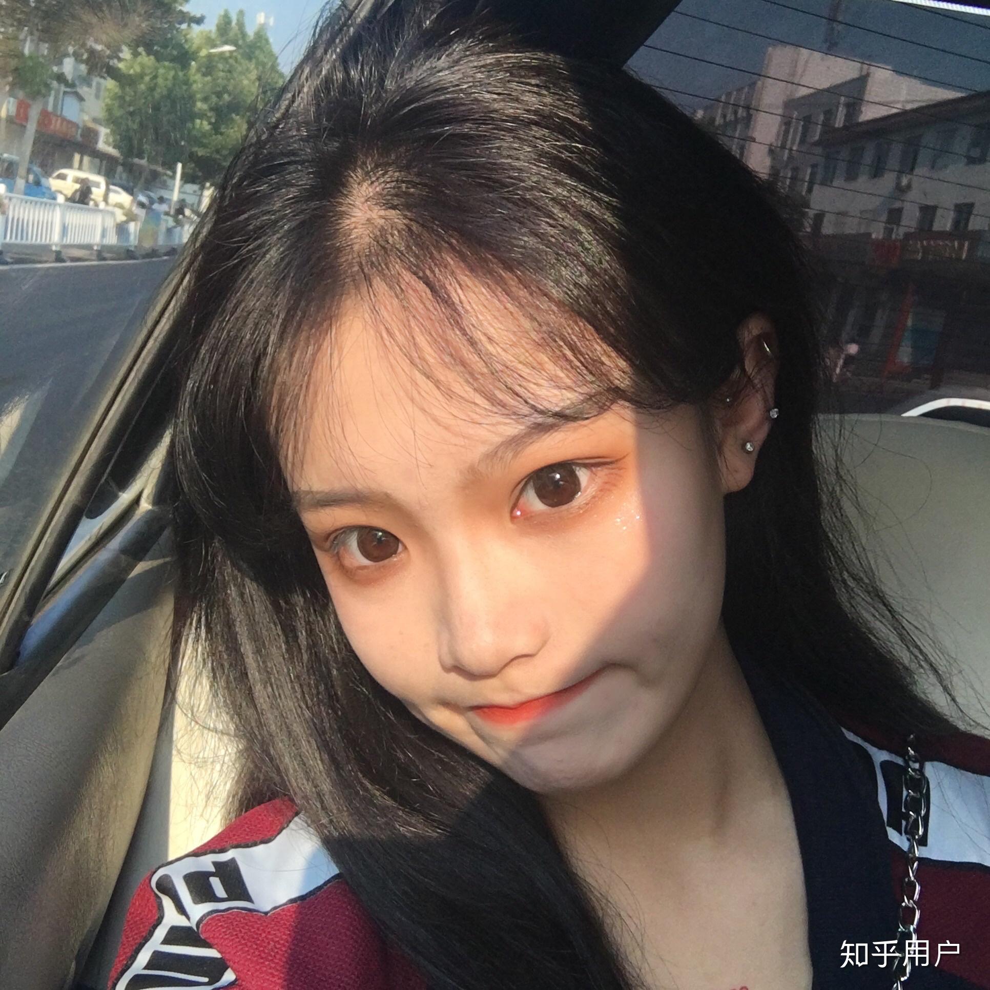 女生头顶头发少是什么体验 ?