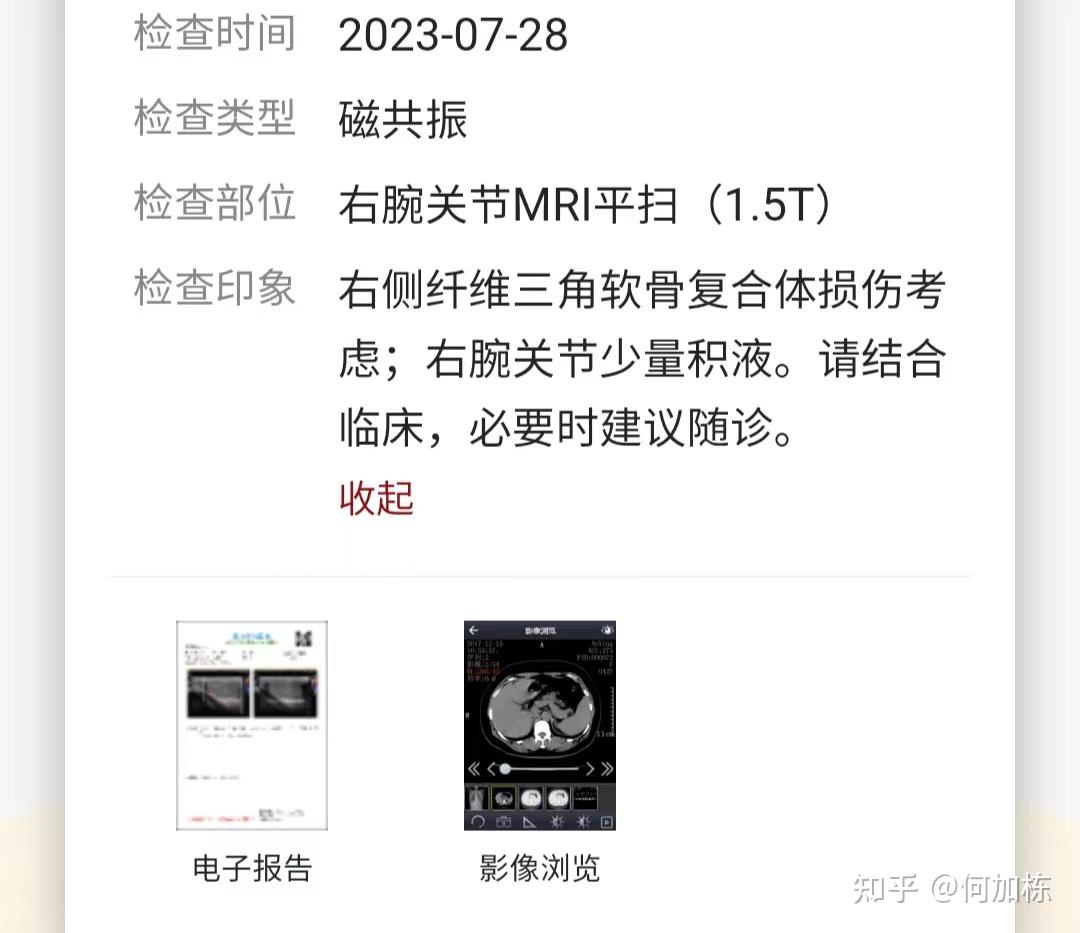 TFCC后,我是如何进行健身训练的 - 知乎