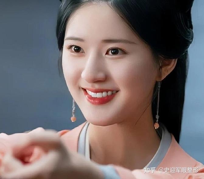 开扇型双眼皮代表赵露思