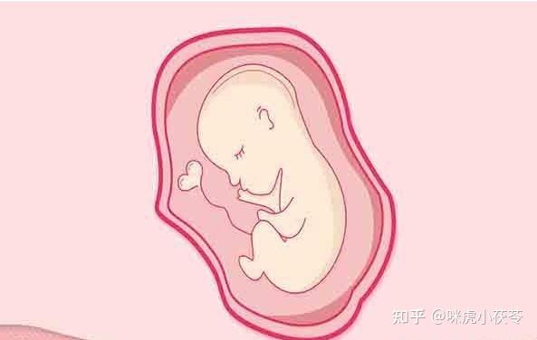 子宫穿孔在什么检查