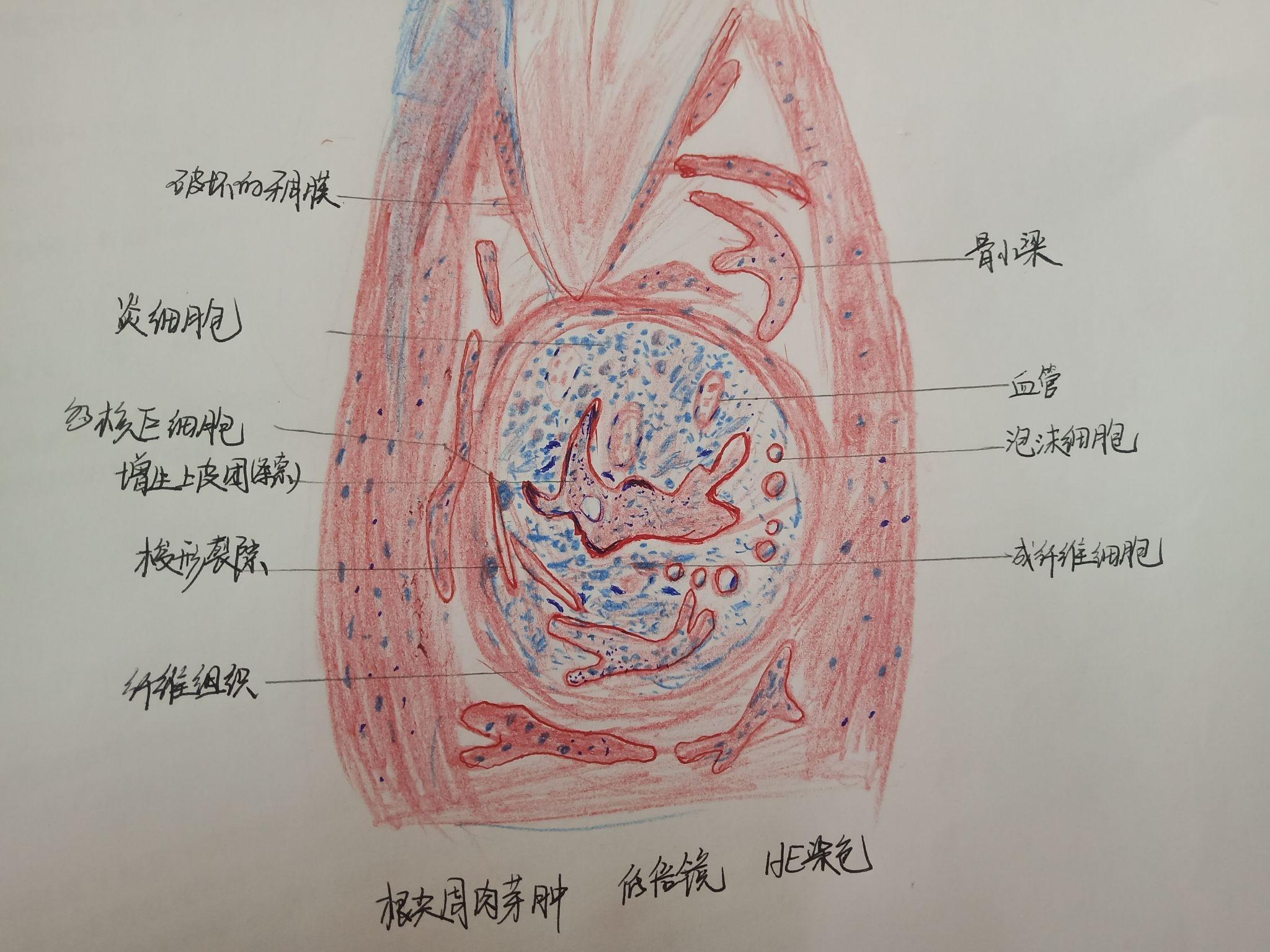 口腔组织病理学红蓝铅笔绘图 