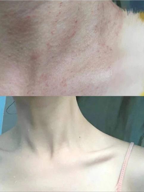 一点儿都不会浪费,嘿嘿~脖子上敏感发红发痒也能用!
