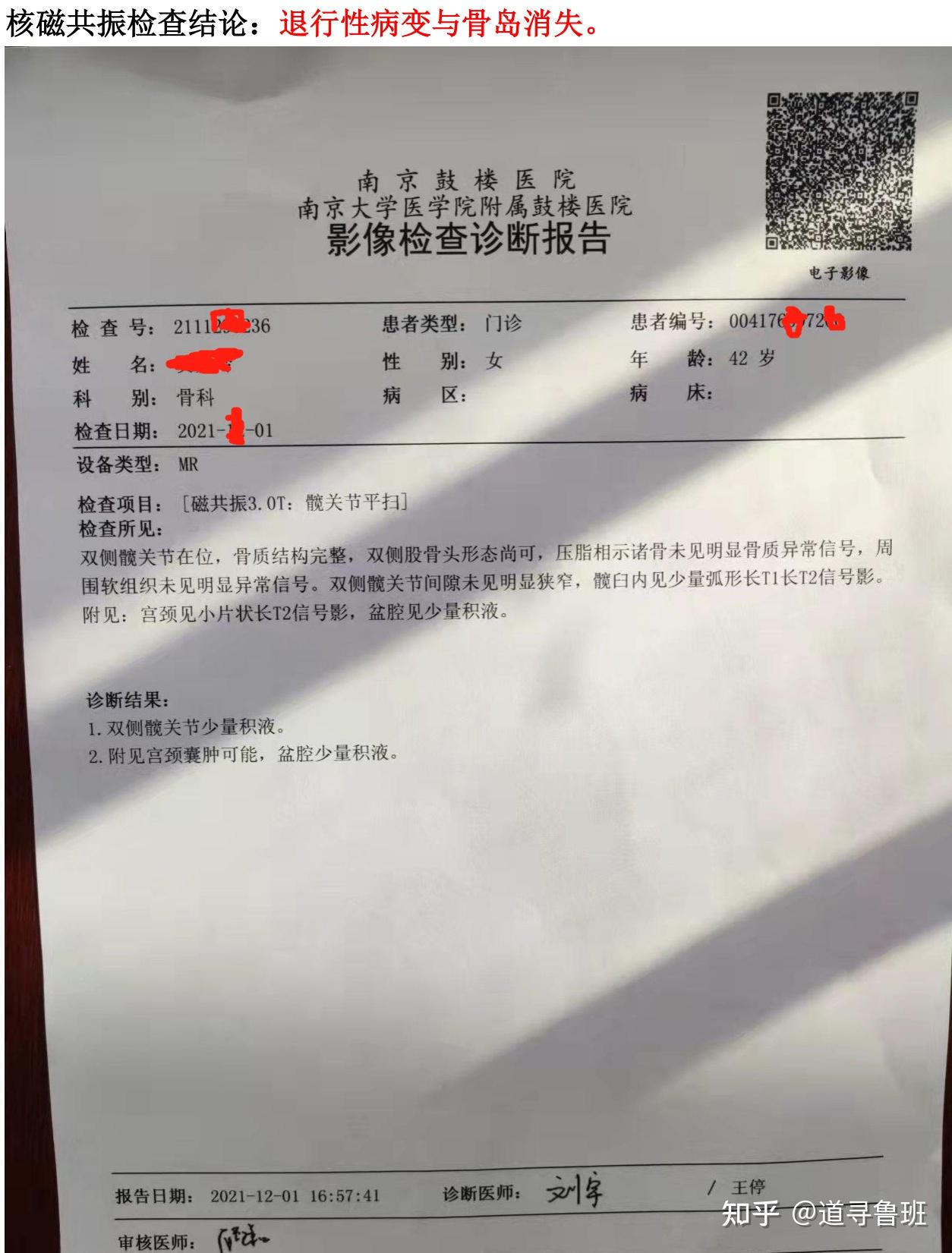 图2 髋关节退行性病变与骨岛复查结果图3 滑膜炎与骨退行性病变治疗