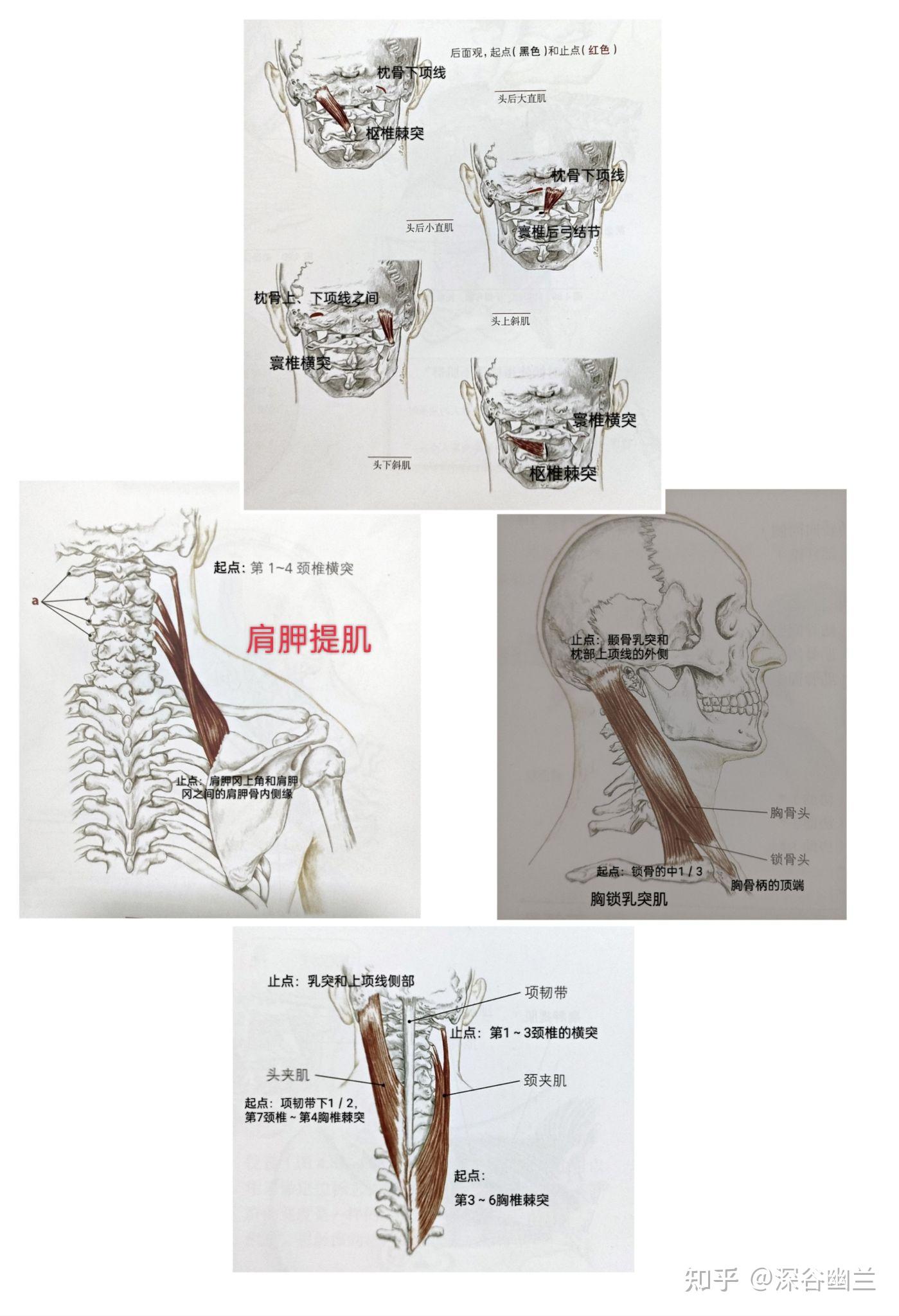 中的头后大直肌和头下斜肌,右侧的肩胛提肌.