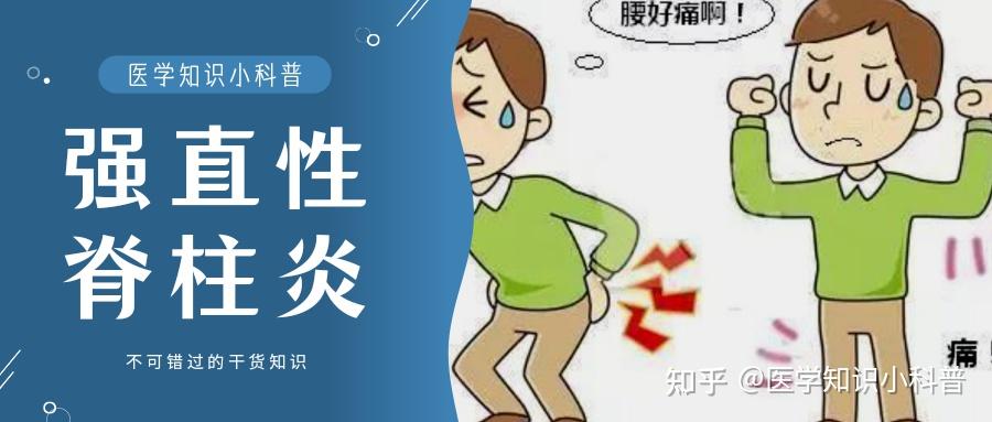 強直性脊柱炎日常護理 - 知乎