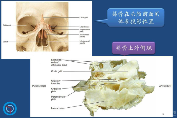 鼻子人人都有,但鼻腔结构异常与鼻腔疾病你知道多少呢? - 知乎
