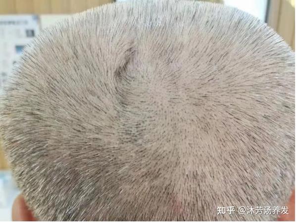白发也分很多种,你是哪一种? - 知乎