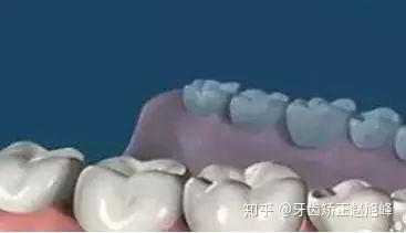 v2-318926c493f1c32d1836321296499525_b.jpg