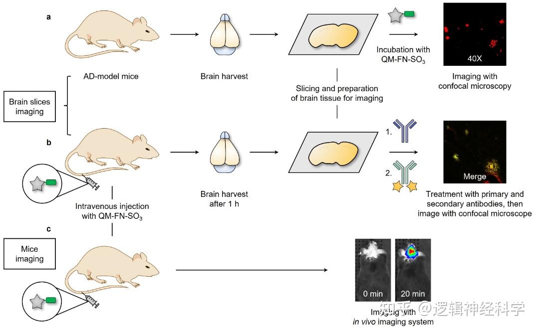 Nat Protoc︱华东理工大学郭志前课题组淀粉样蛋白Aβ检测突破性进展：助力阿尔兹海默症早期诊断 - 知乎