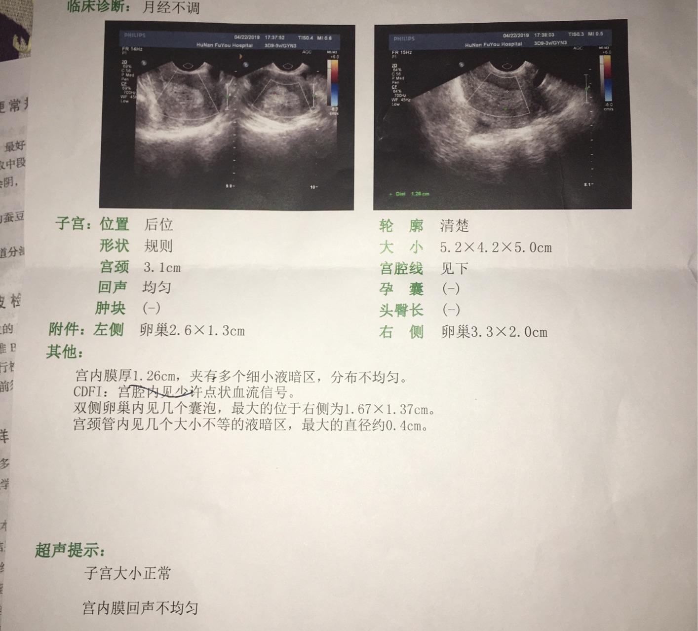 达英35长胖的原理_你好吃达英35 会发胖吗(3)