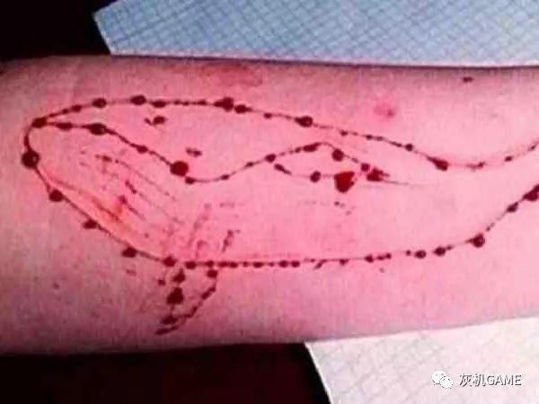 自残甚至自杀的文字组成,它在互联网上的大肆传播,让人联想起了蓝鲸