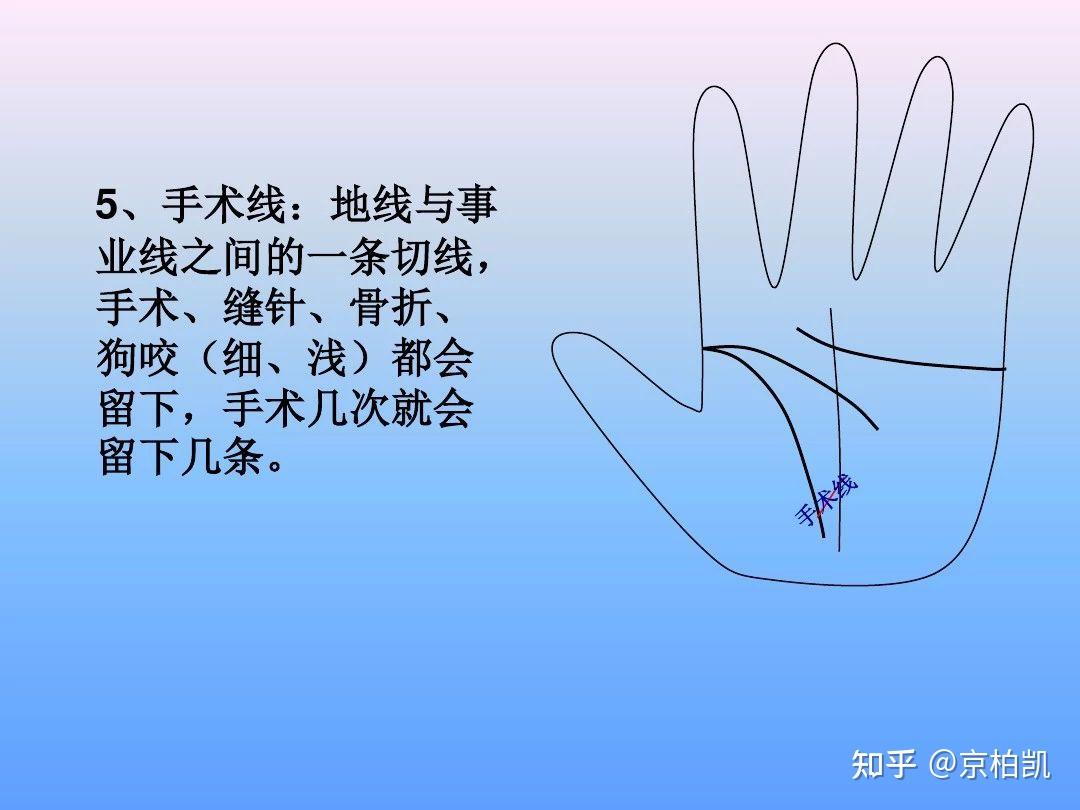 最全手诊图谱（非常实用，建议收藏） - 知乎