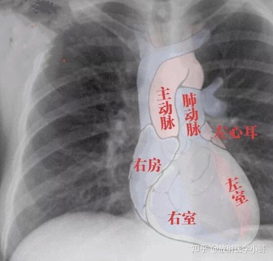 左肺位置图图片