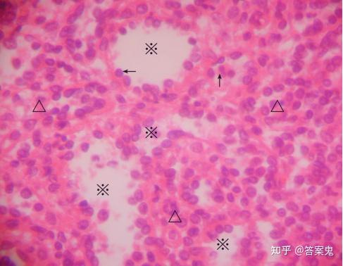 11脾脏(脾脏 he染色10×40) 脾脏的红髓结构包括脾索(△)和脾血窦(※)
