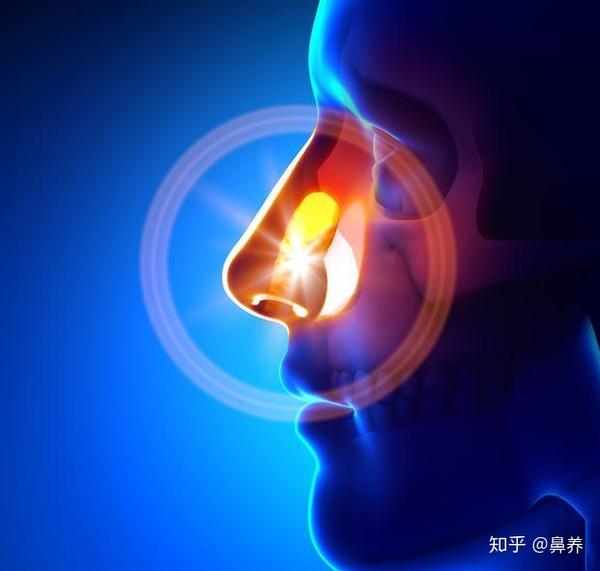 慢性鼻窦炎有何症状表现？
