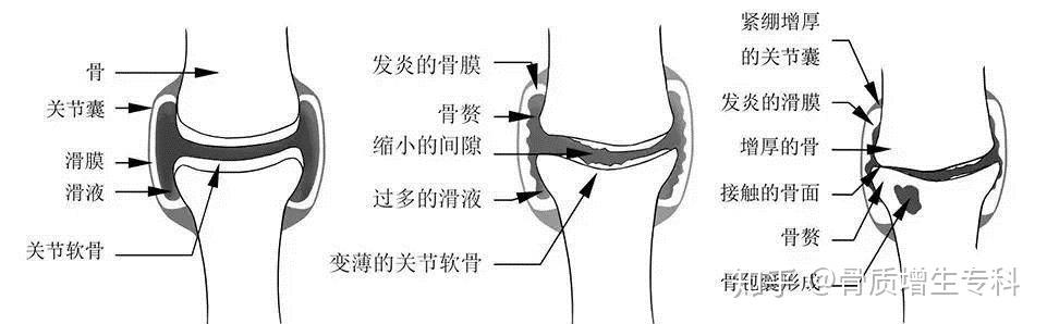 腿骨图解图片