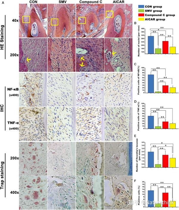 辛伐他汀的局部给药通过抗炎特性和ampkmapknfkb抑制在机械性牙齿移动