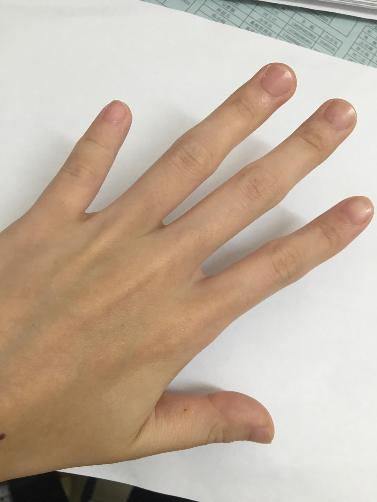 小拇指很短的人能弹钢琴吗