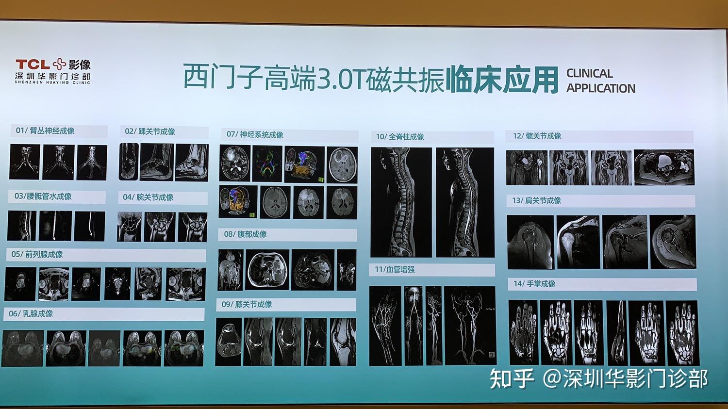 核磁共振检查是主要的医学影像学的成像技术手段,它作用范围特别广