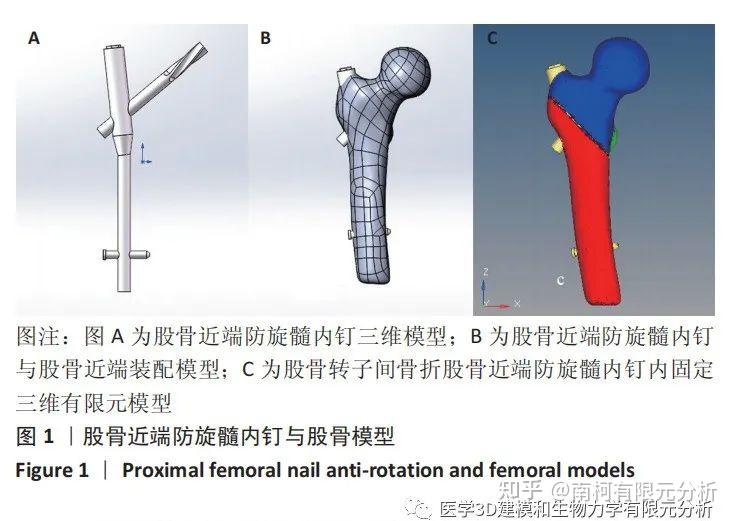 股骨近端防旋髓内钉治疗股骨转子间骨折主钉断钉失效:有限元仿真模型构建及有效性验证 - 知乎