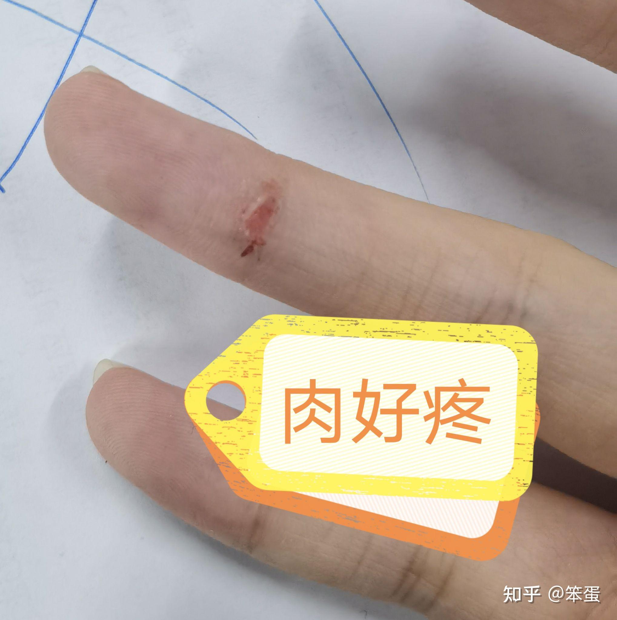 削水果削掉一块肉的变化