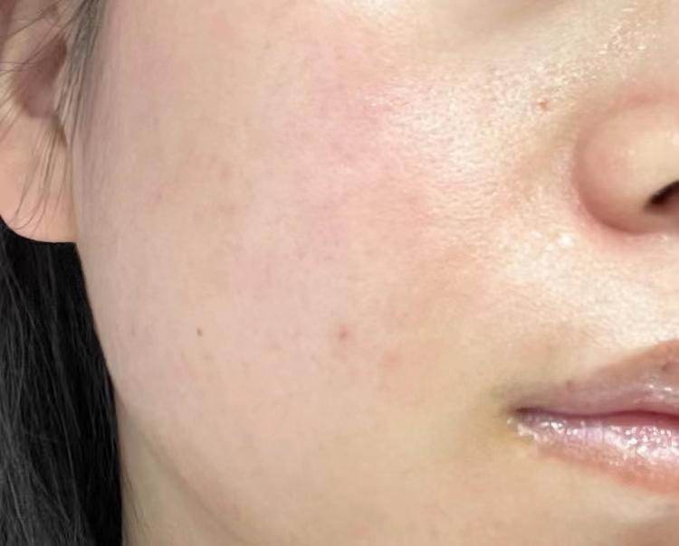 皮肤出现细纹法令纹暗沉无光泽有什么方法可以改善