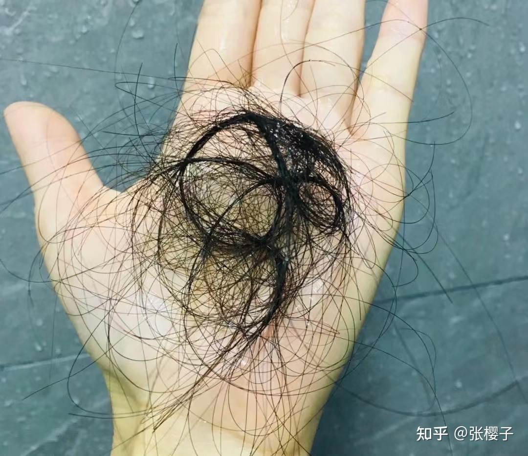 每天洗头掉一堆头发?不知道怎么选防脱洗发水?