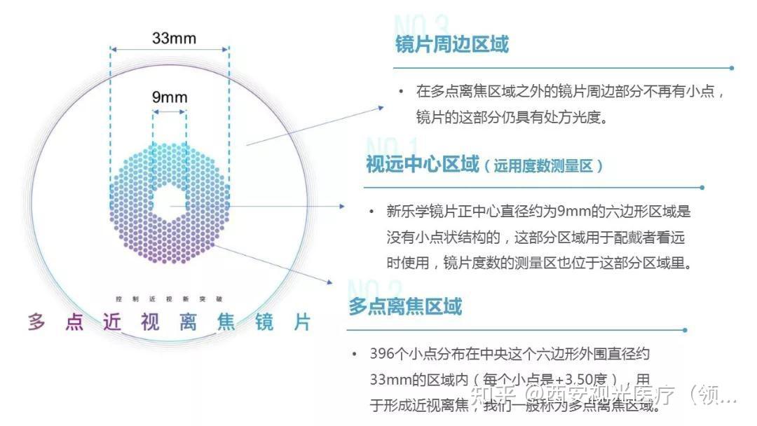 近视防控有意义吗防控镜片有效果吗