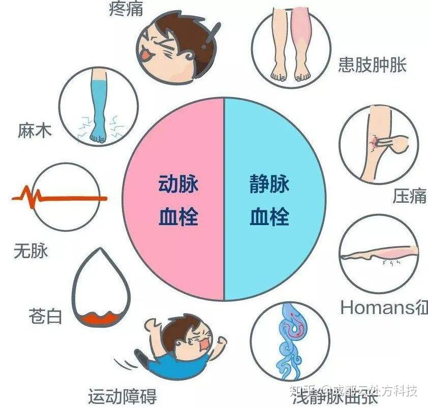 05预防下肢静脉血栓