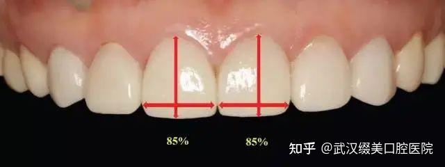 武汉缀美口腔 | 牙齿好看是种什么样的体验? - 知乎