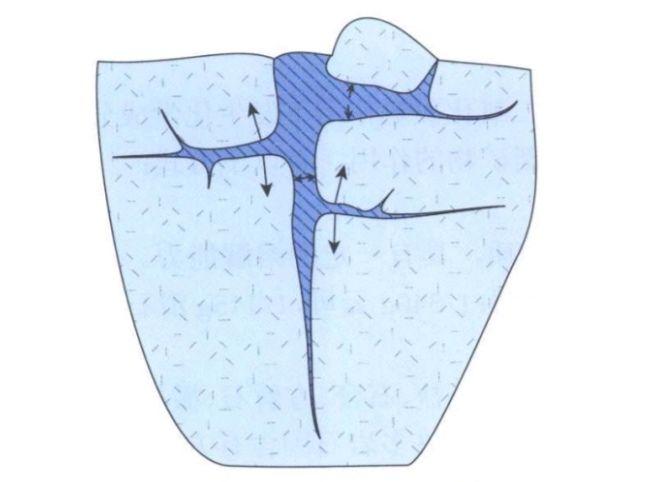 风化作用之一:冰劈作用4.