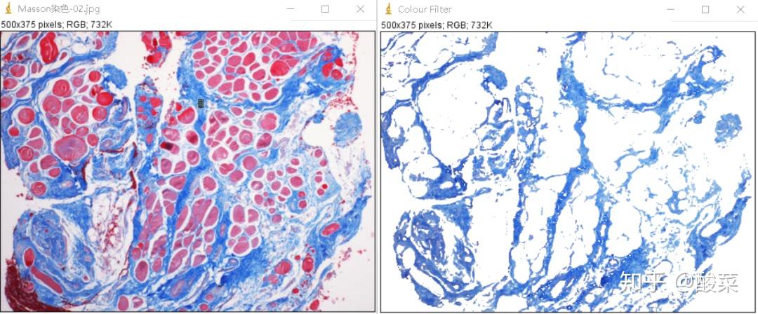 高效图片分析方法colour deconvolution除了可以用来拆分masson染色