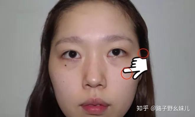 吴昕眼袋被吐槽显老10岁95后小花3岁就有眼袋史上最全祛眼袋科普在