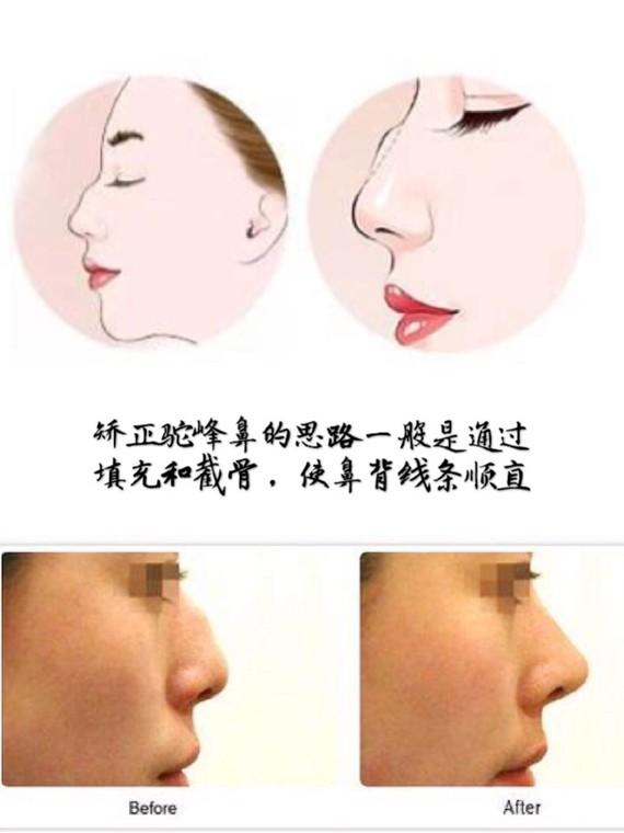 最好看的鼻子是哪种鼻型 v2-3464c528234a1869713e7ad44ac1ea81_1440w.jpg?source=172ae18b