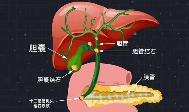 而胰腺正是人體分泌消化酶的主要器官