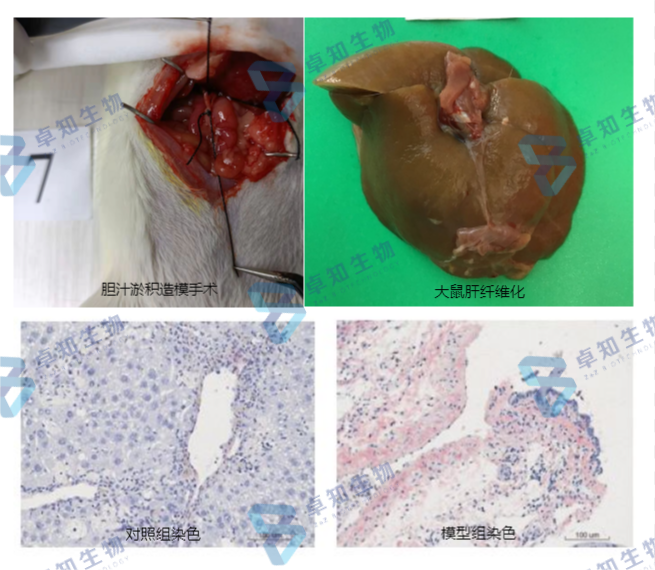 重磅肝货肝脏纤维化模型的构建与选择