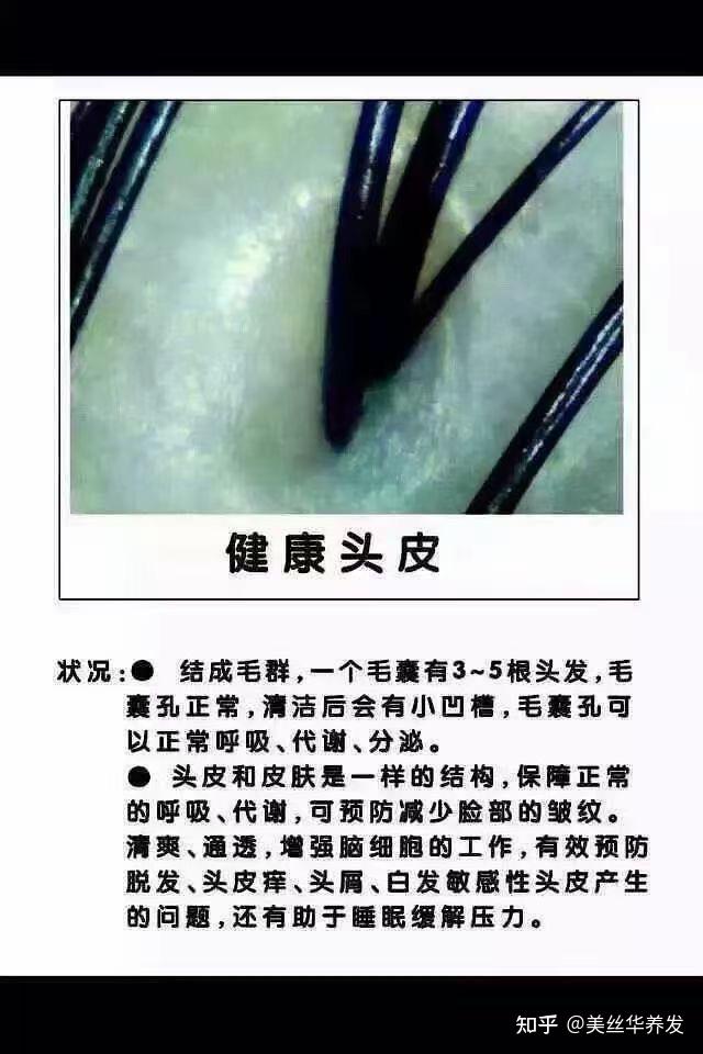amsr是什么以及又有什么作用 知乎