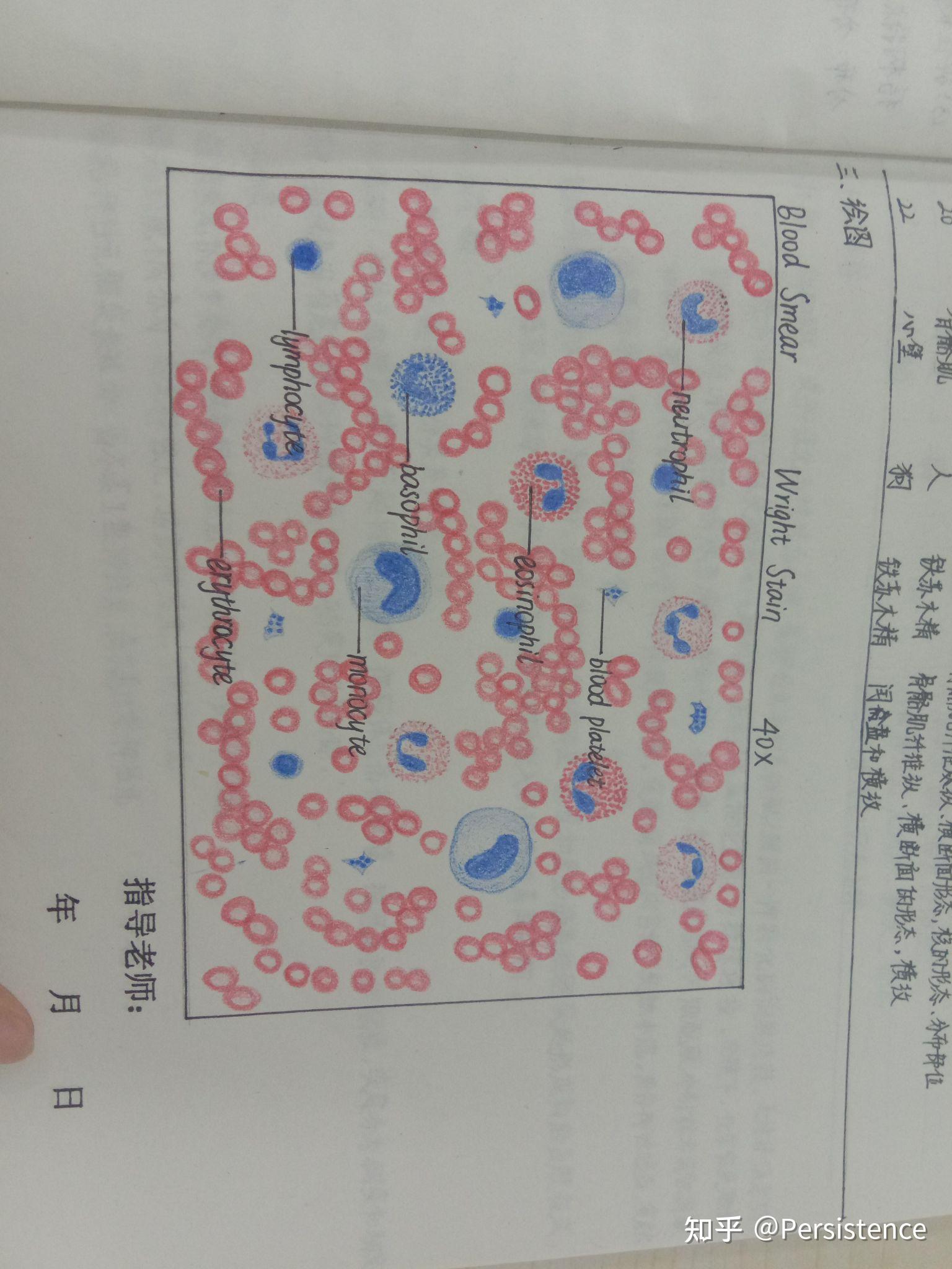 红蓝铅笔浆细胞图片